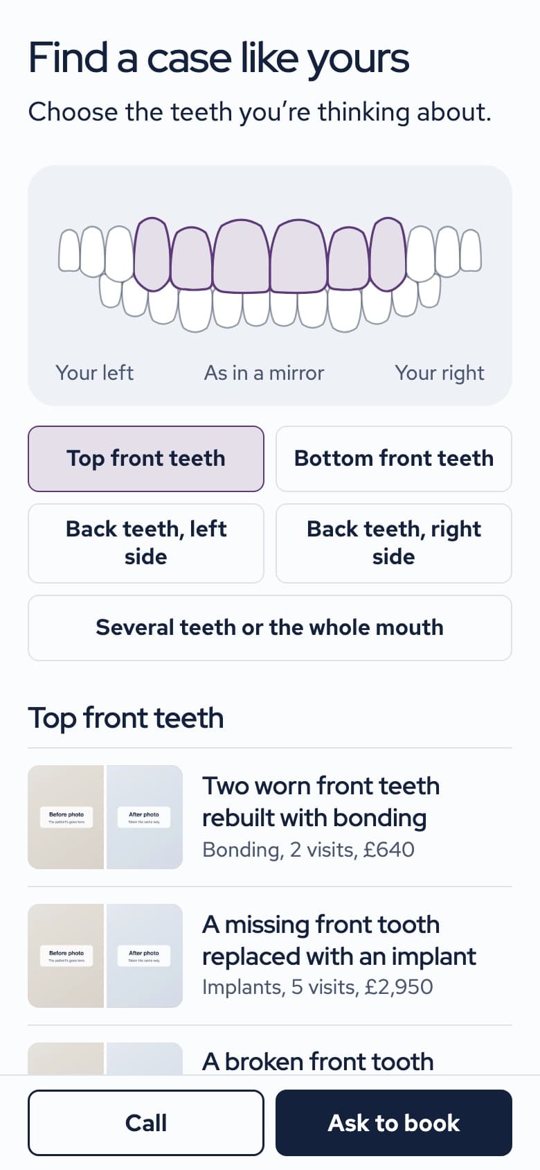 The demo on a phone at "Find a case like yours": a chart of teeth to tap, with matching cases listed below. In Plum.